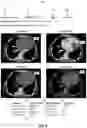 Fig. 15 - Systems and methods for facilitating opportunistic screening for cardiomegaly