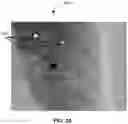 Fig. 03 - Methods of assessing lung disease in chest x-rays