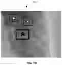 Fig. 04 - Methods of assessing lung disease in chest x-rays