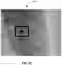 Fig. 05 - Methods of assessing lung disease in chest x-rays