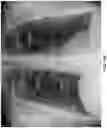 Fig. 21 - Methods of assessing lung disease in chest x-rays