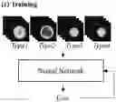Fig. 01 - Artificial intelligence enabled reagent-free imaging hematology analyzer