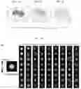 Fig. 11 - Artificial intelligence enabled reagent-free imaging hematology analyzer