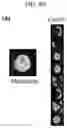 Fig. 13 - Artificial intelligence enabled reagent-free imaging hematology analyzer