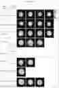Fig. 18 - Artificial intelligence enabled reagent-free imaging hematology analyzer