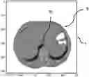 Fig. 01 - Identifying boundaries of lesions within image data