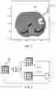 Fig. 02 - Identifying boundaries of lesions within image data