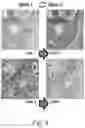 Fig. 07 - IMPROVED HISTOPATHOLOGY CLASSIFICATION THROUGH MACHINE SELF-LEARNING OF 