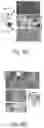 Fig. 09 - IMPROVED HISTOPATHOLOGY CLASSIFICATION THROUGH MACHINE SELF-LEARNING OF 