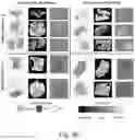 Fig. 15 - IMPROVED HISTOPATHOLOGY CLASSIFICATION THROUGH MACHINE SELF-LEARNING OF 