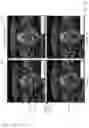 Fig. 13 - Automatic contour adaptation using three sub-networks of a neural network