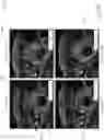 Fig. 14 - Automatic contour adaptation using three sub-networks of a neural network