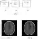 Fig. 05 - Method and system for generating magnetic resonance image, and computer readable storage medium
