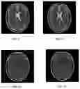 Fig. 06 - Method and system for generating magnetic resonance image, and computer readable storage medium
