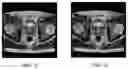 Fig. 07 - Method and system for generating magnetic resonance image, and computer readable storage medium