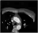 Fig. 01 - Cone beam artifact correction for gated imaging