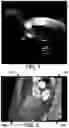 Fig. 04 - Cone beam artifact correction for gated imaging
