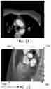 Fig. 07 - Cone beam artifact correction for gated imaging