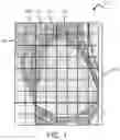 Fig. 02 - Weakly supervised learning with whole slide images