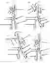 Fig. 20 - Method for Teaching Precision Body Movements and Complex Patterns of Activity