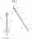 Fig. 02 - Bow for a bowed string musical instrument