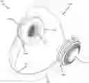 Fig. 01 - Noise control