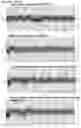 Fig. 27 - METHOD FOR SELECTING PATIENT SPECIFIC THERAPY