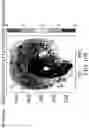 Fig. 146 - METHODS AND SYSTEMS FOR DETERMINING GENE EXPRESSION PROFILES AND CELL IDENTITIES FROM MULTI-OMIC IMAGING DATA