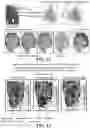 Fig. 18 - METHODS AND SYSTEMS FOR DETERMINING GENE EXPRESSION PROFILES AND CELL IDENTITIES FROM MULTI-OMIC IMAGING DATA