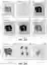 Fig. 30 - METHODS AND SYSTEMS FOR DETERMINING GENE EXPRESSION PROFILES AND CELL IDENTITIES FROM MULTI-OMIC IMAGING DATA