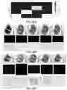Fig. 35 - METHODS AND SYSTEMS FOR DETERMINING GENE EXPRESSION PROFILES AND CELL IDENTITIES FROM MULTI-OMIC IMAGING DATA