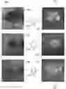 Fig. 01 - COMPUTERIZED SYSTEMS FOR PREDICTION OF GEOGRAPHIC ATROPHY PROGRESSION USING DEEP LEARNING APPLIED TO CLINICAL IMAGING