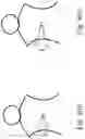 Fig. 09 - METHOD AND SYSTEM FOR ADJUSTING INTERACTIVE 3D TREATMENT ZONE FOR PERCUTANEOUS TREATMENT