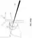 Fig. 22 - METHOD AND SYSTEM FOR ADJUSTING INTERACTIVE 3D TREATMENT ZONE FOR PERCUTANEOUS TREATMENT