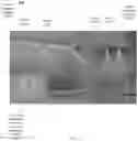 Fig. 14 - Systems and apparatuses for configurable and controllable under cabinet lighting fixtures