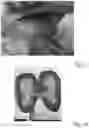 Fig. 19 - METHOD AND APPARATUS FOR RECONDITIONING ORGANS