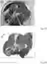 Fig. 20 - METHOD AND APPARATUS FOR RECONDITIONING ORGANS