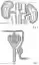 Fig. 02 - METHOD AND APPARATUS FOR RECONDITIONING KIDNEYS