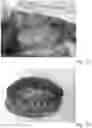 Fig. 13 - METHOD AND APPARATUS FOR RECONDITIONING KIDNEYS