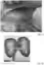 Fig. 19 - METHOD AND APPARATUS FOR RECONDITIONING KIDNEYS