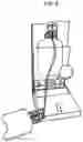 Fig. 05 - Systems and methods for extraction and cryopreservation of bone marrow