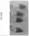 Fig. 27 - Systems and methods for extraction and cryopreservation of bone marrow
