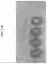 Fig. 28 - Systems and methods for extraction and cryopreservation of bone marrow