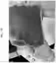 Fig. 29 - Systems and methods for extraction and cryopreservation of bone marrow