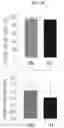 Fig. 38 - Systems and methods for extraction and cryopreservation of bone marrow
