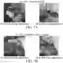 Fig. 06 - LIPID ENCASING AMPHIPATHIC PEPTIDES
