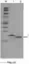 Fig. 11 - Sweet protein from truffle