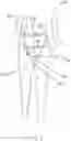 Fig. 07 - Body shape enhancing apparatus and method