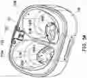 Fig. 09 - Receiving box for hearing assistance device