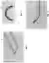 Fig. 07 - METHOD AND APPARATUS FOR MANIPULATING THE SIDE WALL OF A BODY LUMEN OR BODY CAVITY SO AS TO PROVIDE INCREASED VISUALIZATION OF THE SAME AND/OR INCREASED ACCESS TO THE SAME, AND/OR FOR STABILIZING INSTRUMENTS RELATIVE TO THE SAME